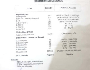 Neuro Muscular Disorder