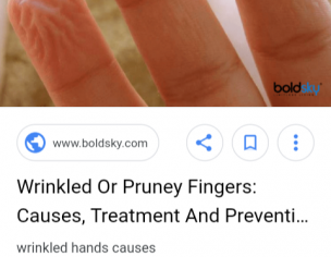 Pruny Or Wrinkles On Fingers