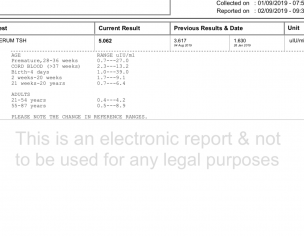 Twin Pregnancy Tsh Is High
