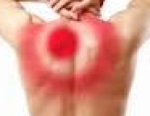 Upper Back Muscular Pain