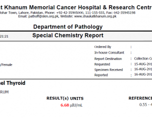 TSH , Dealy Perioed, No Conception Since 2year Married. 