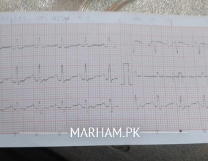 Afraid Of Heart Desease