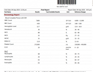 Tachycardia,Thyroid Homone Issue