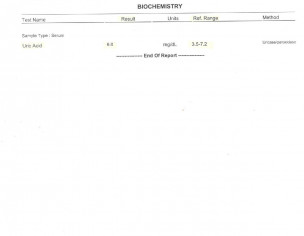 HEEL SPUR &amp; ACHILIES TENDINITIS