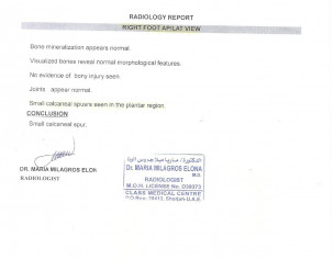 HEEL SPUR &amp; ACHILIES TENDINITIS