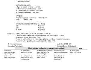 Skin Cancer Basal Cell ( Clark V )