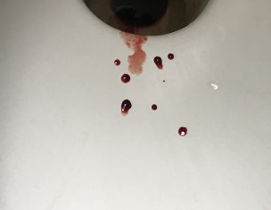 Problem Related Conception