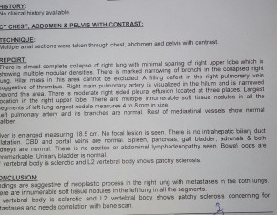 Lungs Cancer Stage 4