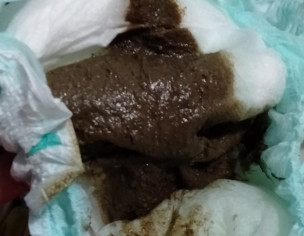 Poop Color