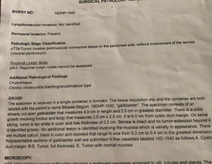 Moderately Differentiated  Adenocarcinoma G2