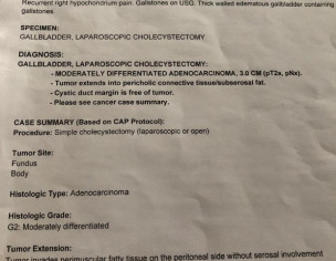 Moderately Differentiated  Adenocarcinoma G2