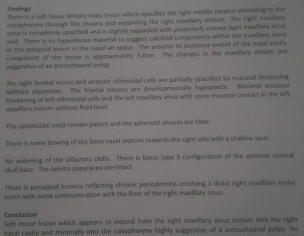Nasal Polyps, Both Nose And One Ear Blocked