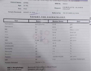 Past Typhoid  Treatment Done Now Severe Stomach Problem