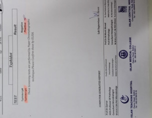 Past Typhoid  Treatment Done Now Severe Stomach Problem