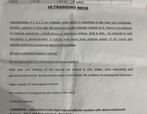 Cyst In Neck 