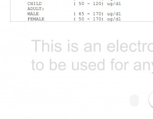 Iron Deficiency With Hashimoto Hypothyroidism 