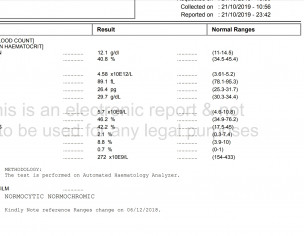 Iron Deficiency With Hashimoto Hypothyroidism 