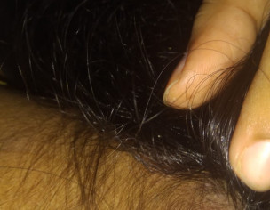Scalp Problem