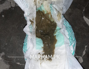 Black Stool After Surgery