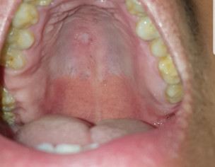 I Don't Know What Is This.