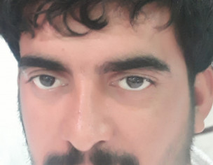 Sir Underbait Ka Ilaj Pakistan My Ho Sakta Hy