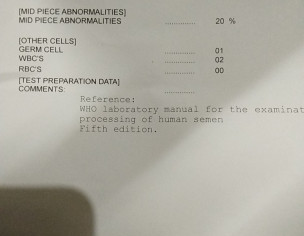 Hypogonadism