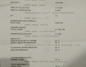 Hypogonadism