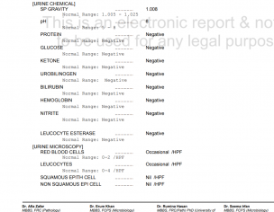 Check My UDR Report Plz