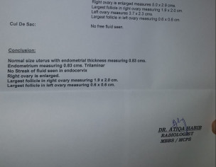 Conceive Report Check