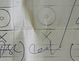 Cataract Eye Surgery