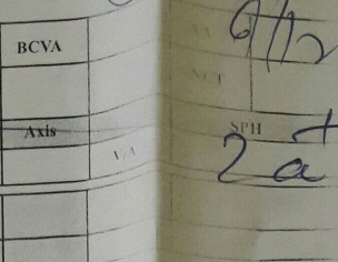 Cataract Eye Surgery