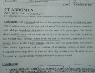 Gall Bladder Mass And Heaptic Invasion