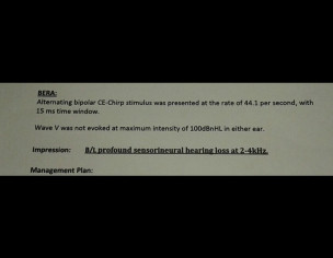 Profound Hearing Loss