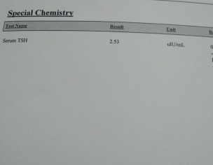 TSH Level Defrance Reports  Just In 10 Days ! Need Doctors Support