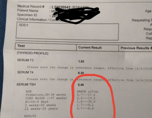 TSH Level Defrance Reports  Just In 10 Days ! Need Doctors Support