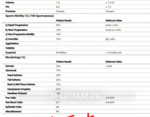 Bilatteral Varicocele