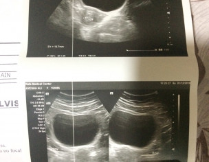 Gynaecological Issue