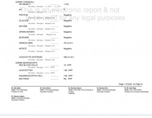 Irritated Urine With Blood Drops