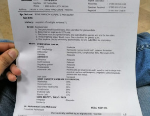 Blood Cancer (Multiple Myeloma) - Best Doctor &amp; Treatment