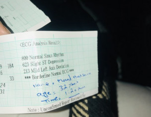 Chest Pain And High Blood Pressure 