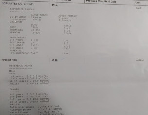 Infertility