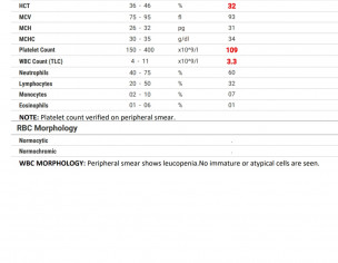 Platelets Decrease 