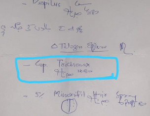 Hair Loss After Illness (Telogen Efflivium) 