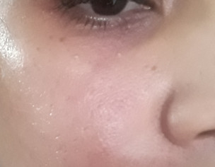 Skin Care Routine/ Rashes 