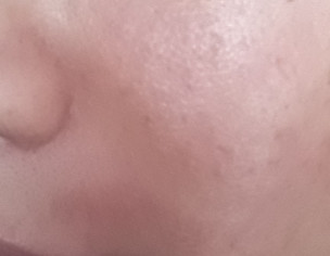 Skin Care Routine/ Rashes 