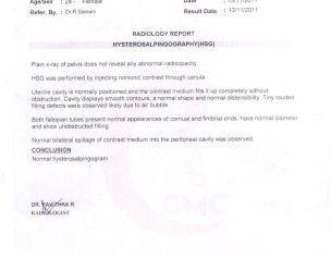 Unexplained Infertility 