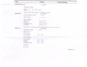 Unexplained Infertility 