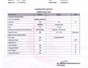 Unexplained Infertility 