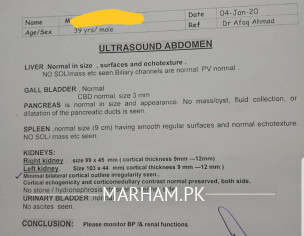 High Creatinine 1.27 Uric Acid 7.8