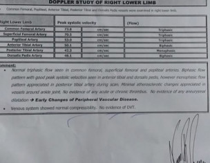 Blackening Of Lower Leg After An Accident+surgery